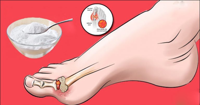 articulatii umflate la degete artrita articulațiilor medicației piciorului